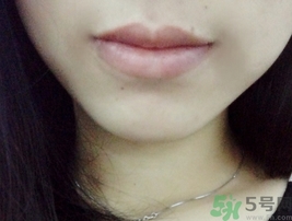 ѩ�����󴽸���ô��?ѩ�����󴽸������?